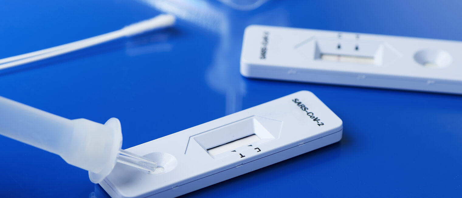 Corona; Corona-Test; Virus; Covid-19; Test